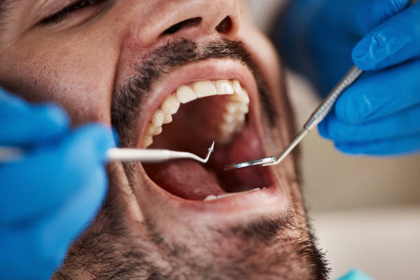 Best Broken or Chipped Tooth Repair in Forked River, NJ