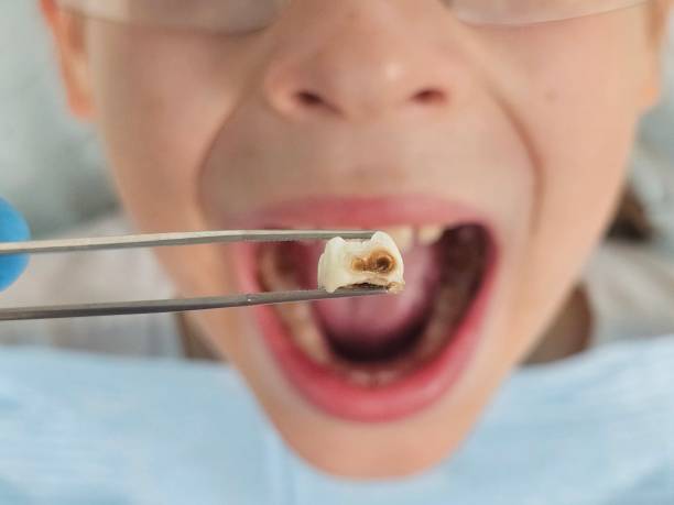 Best Emergency Cosmetic Dentistry (e.g., broken veneers) in Forked River, NJ